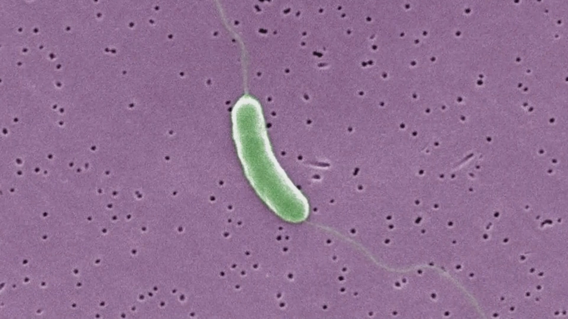 Florida health officials confirm fifth death from flesh-eating bacteria ...