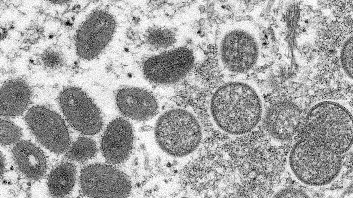 WHO Meeting on Monkeypox: Will it become a global emergency? - Vimarsana News