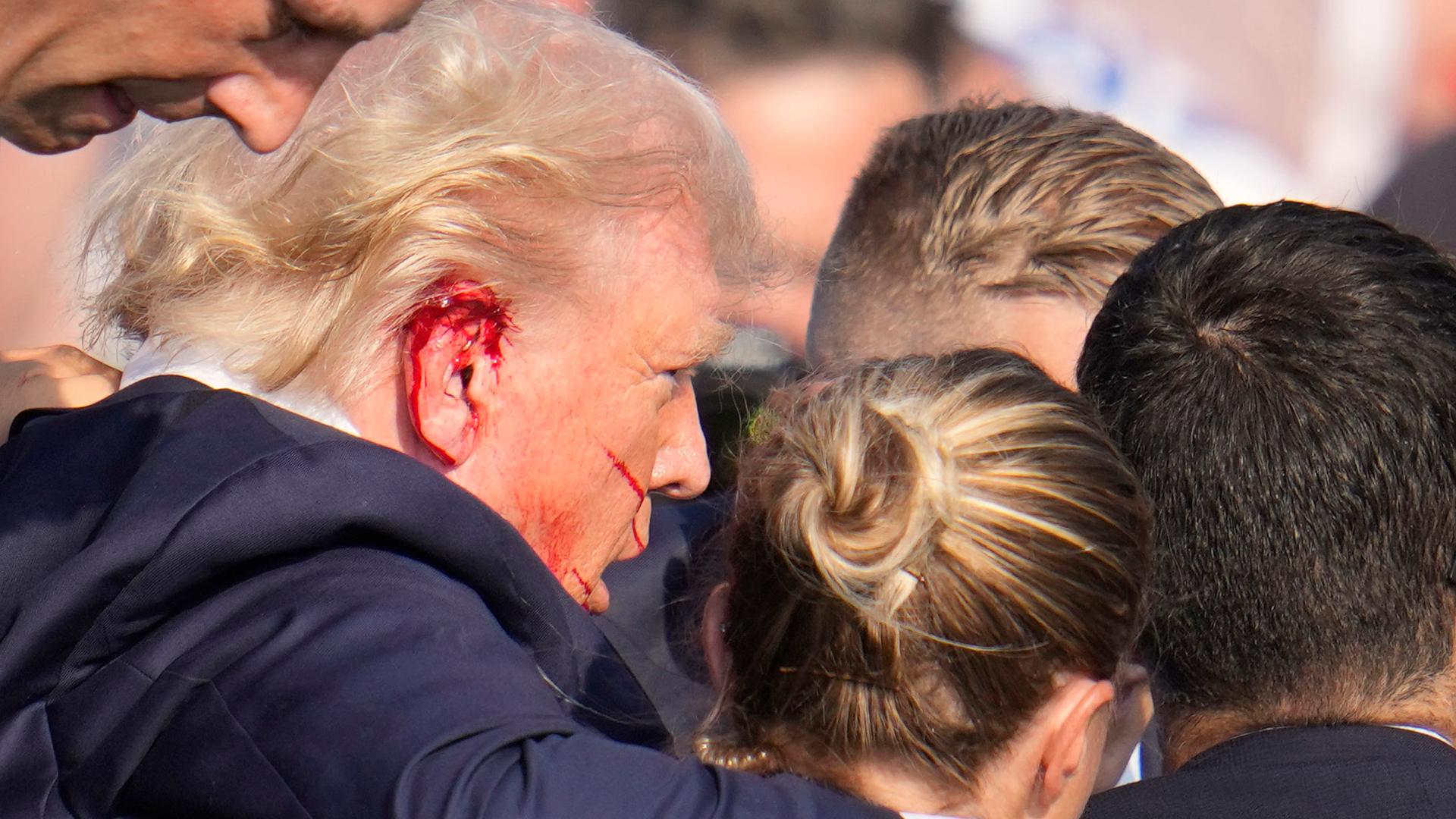 FBI confirms Trump was struck by bullet at rally | abc10.com