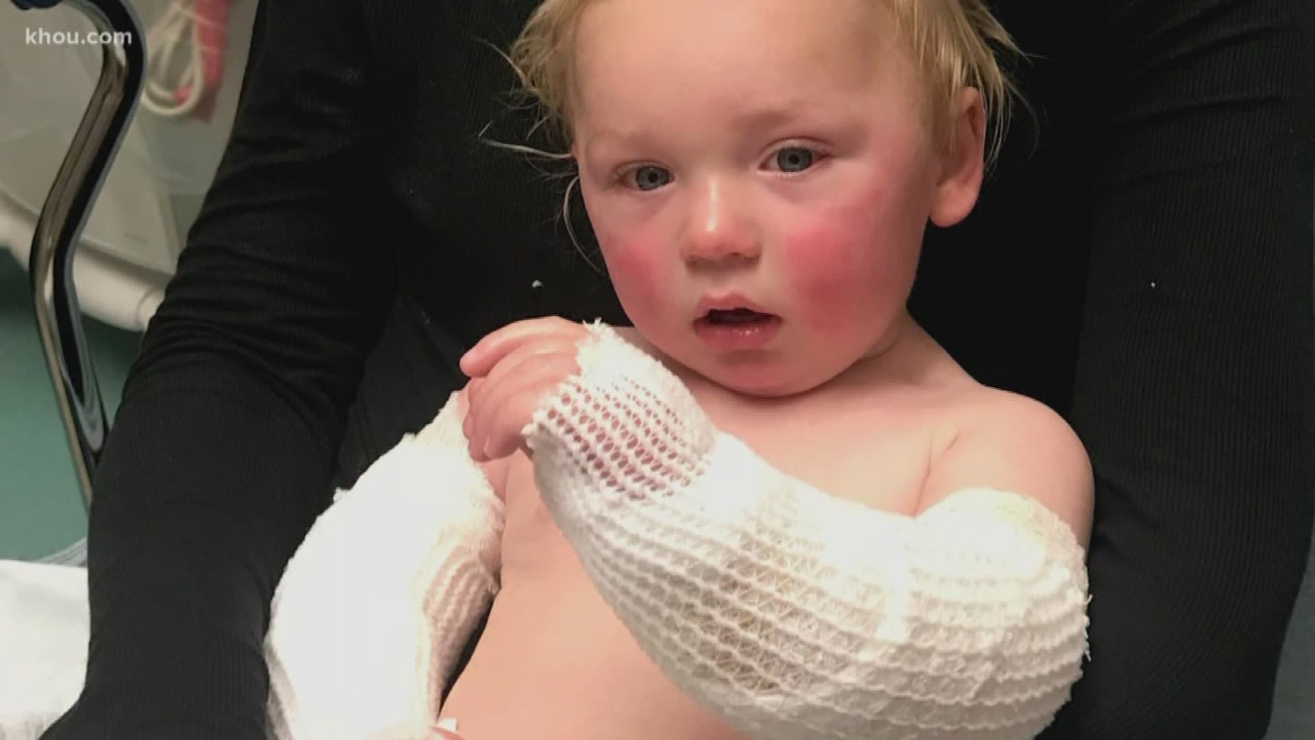 Sixteen-month-old Ayden Brown grabbed the handle of a pot of boiling water and spilled it on himself.