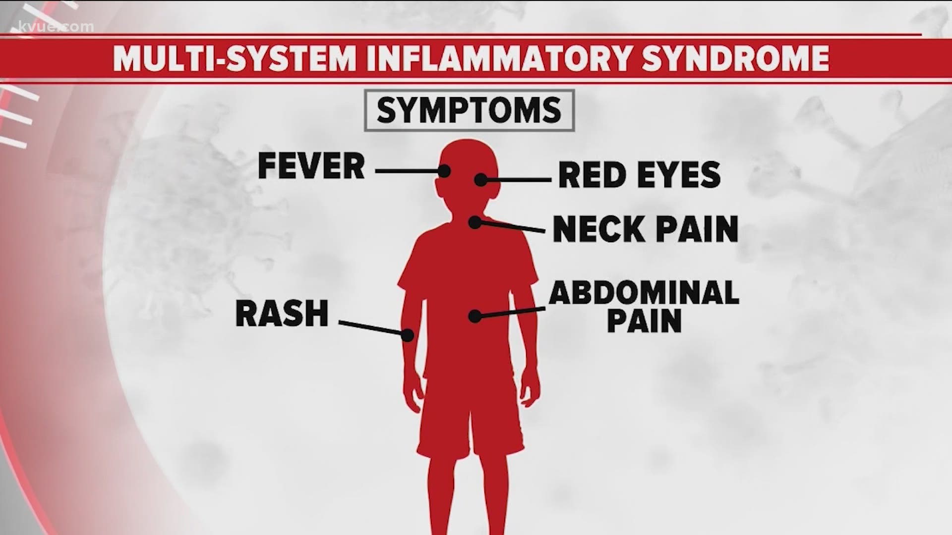 Deadly Illness In Children Linked To Covid 19 Confirmed In Austin Hospital More Cases Suspected Abc10 Com