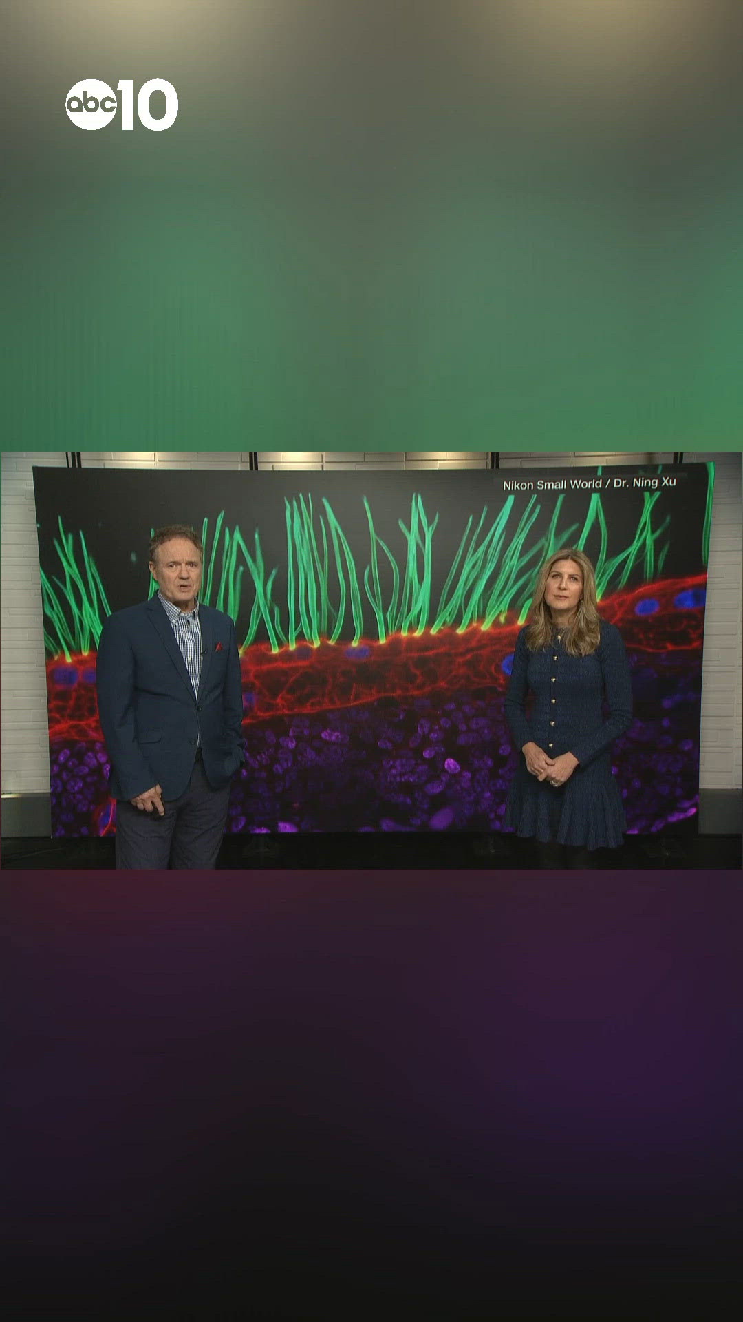 Microscope Use Guid Nikon disqualifies microscopy contest winner over generative AI use ...