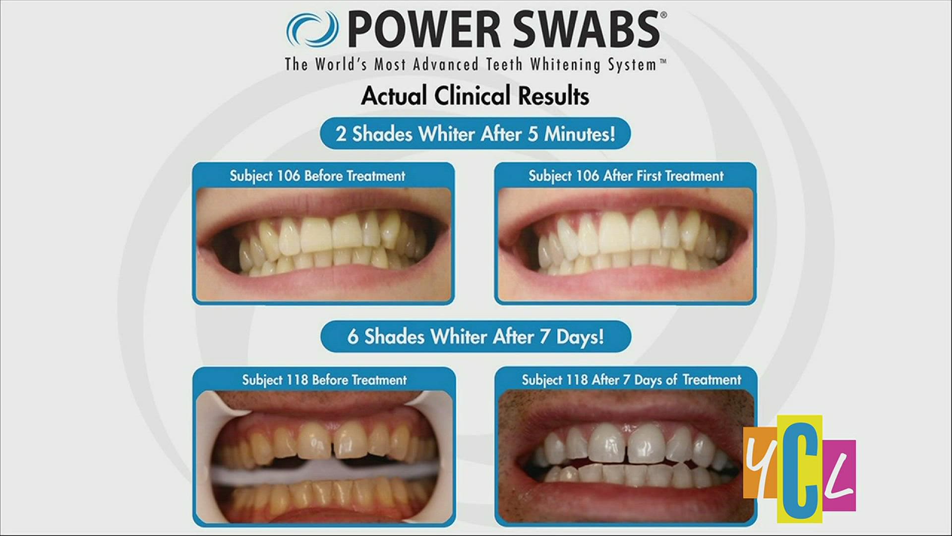 With the use of Power Swabs, wow a crowd with your bright white smile. This segment paid for by True Earth Health Solutions.