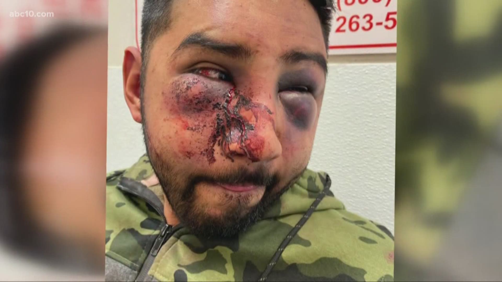 Supporters want an outside investigating into the beating of 29-year-old Jacob Servin. They also want to know the names of the officers involved.