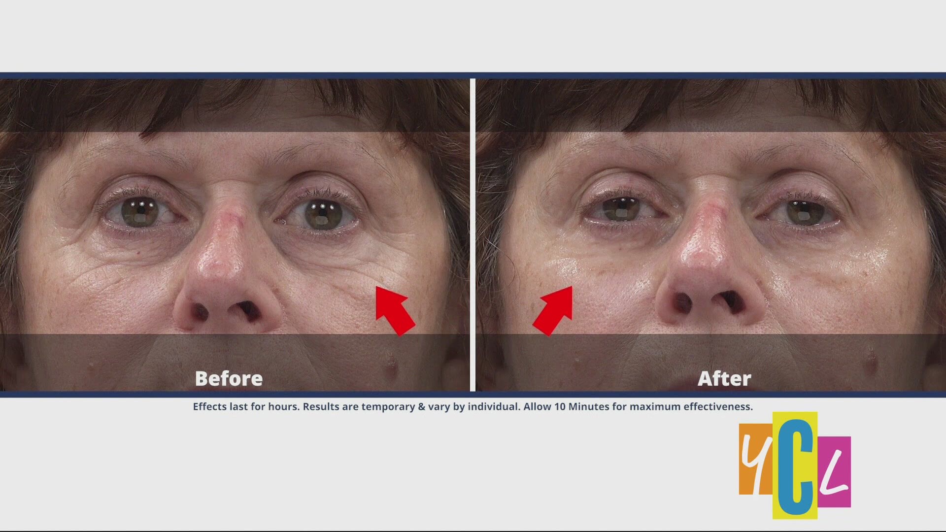 Reduce Under Eye Bags Dark Circles and Wrinkles from View