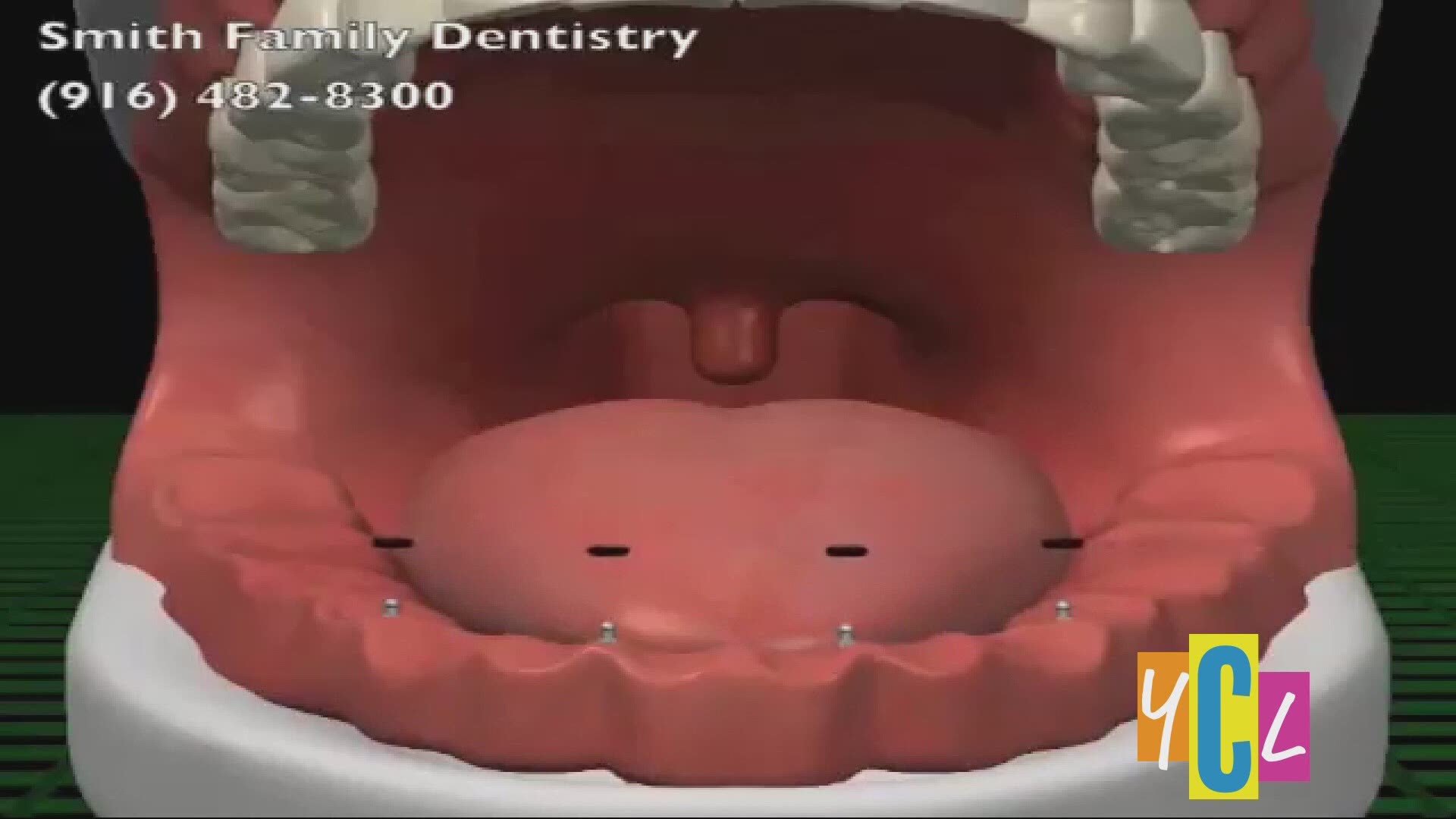 Dr. Andrea Joy Smith tells us about the many benefits included with mini dental implants. This segment was paid for by Dr. Andrea Joy Smith.