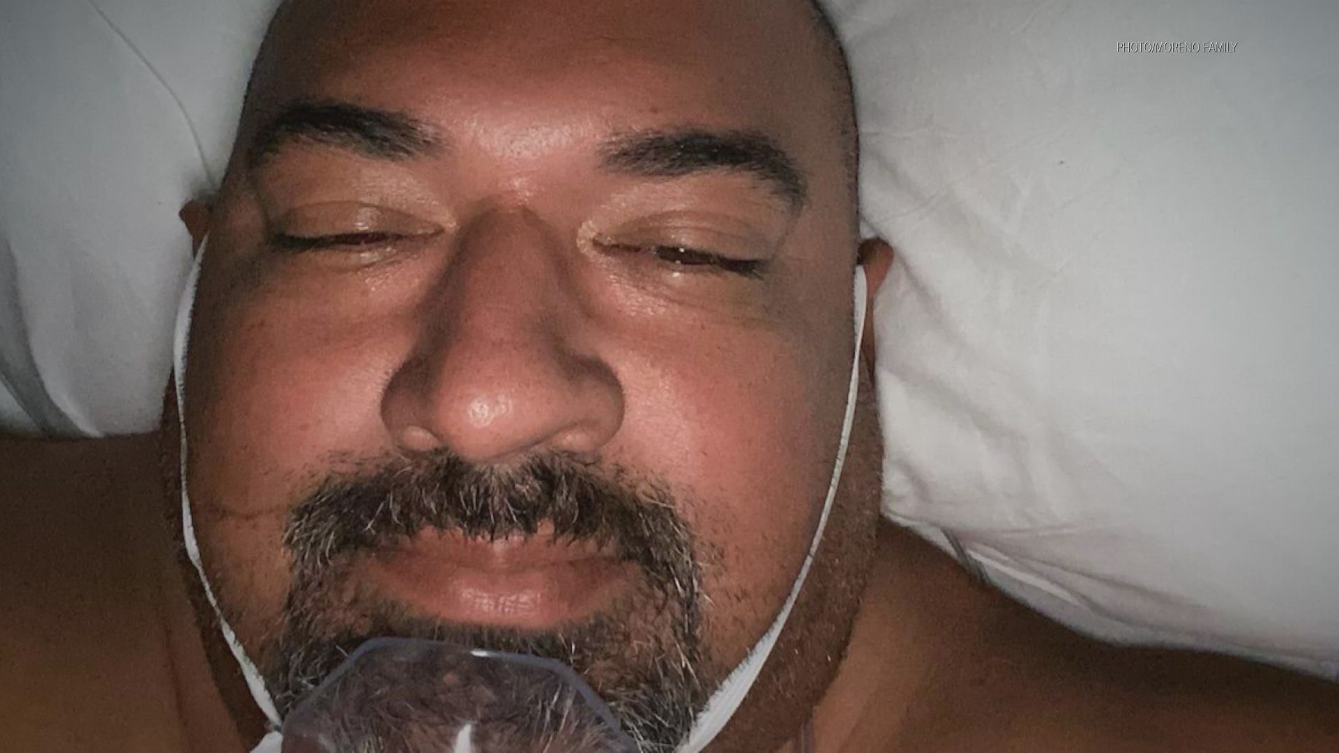 Anthony “Big Bunk” Moreno, 49, has been intubated in the Intensive Care Unit at the University of California Medical Center in Sacramento while battling coronavirus.