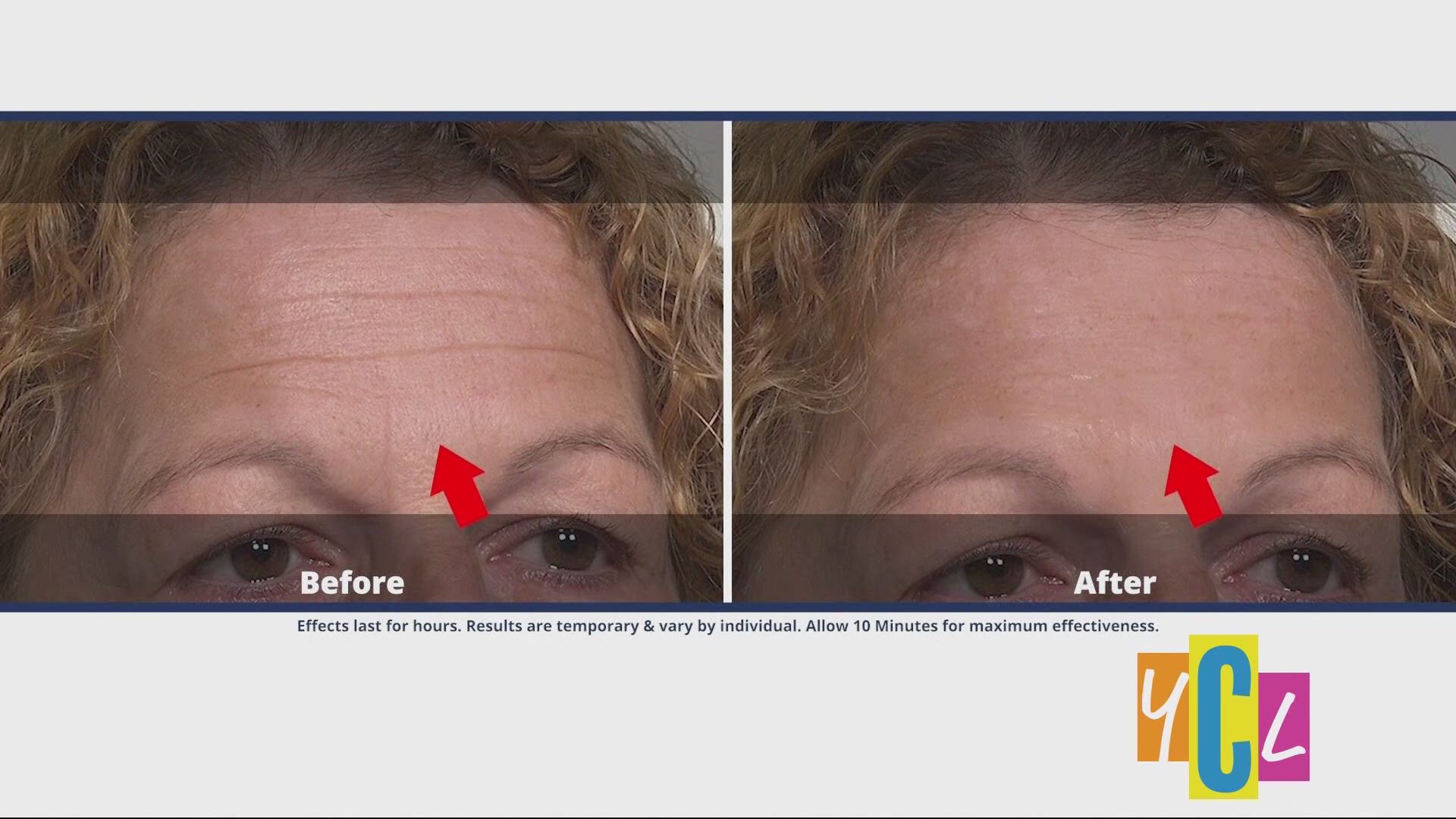 Improve the appearance of fine wrinkles and lines using Plexaderm. This segment was sponsored by True Earth Health Solutions.