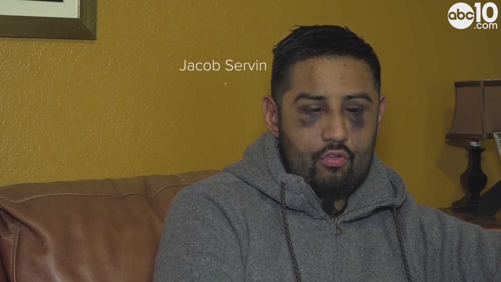 29-year old Jacob Servin of Stockton says he was beaten excessively by San Joaquin County Sheriffs Officers after he was arrested for alleged public drunkenness.