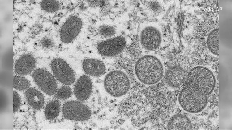 Monkeypox DNA found in Sacramento wastewater samples