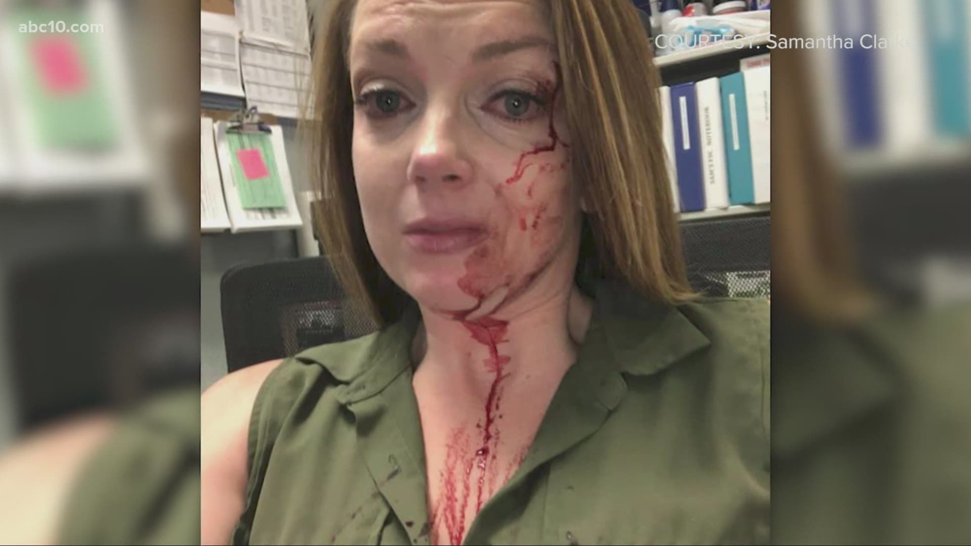 Samantha Clarke said she was "split open pretty good" two weeks ago when she was allegedly assaulted by a customer while working at a Big 5 Sporting Goods store.