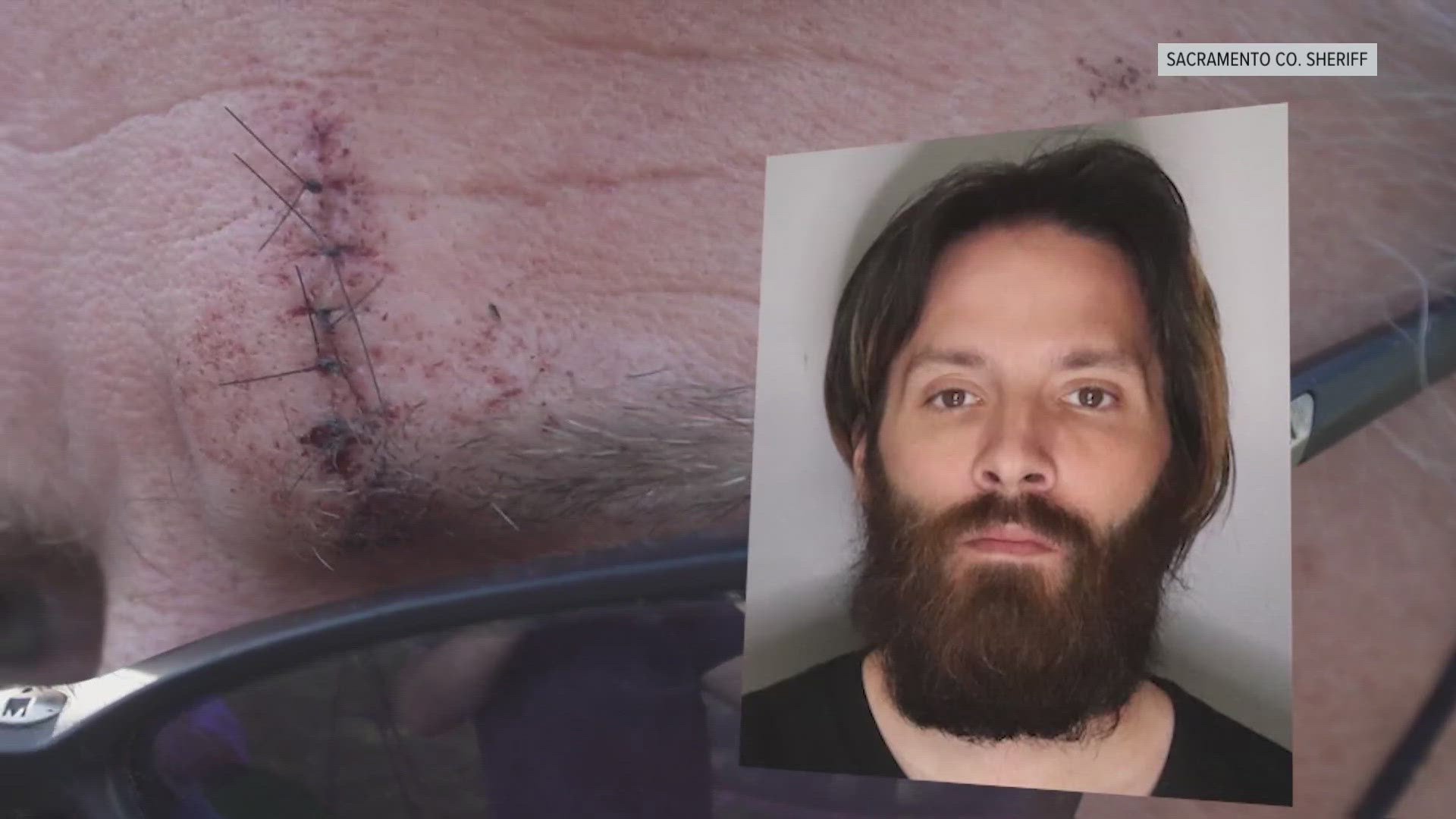 The man says he was dropping his daughter off at work around 7 a.m. when he jumped in to help a Grocery Outlet employee from being attacked by another man.