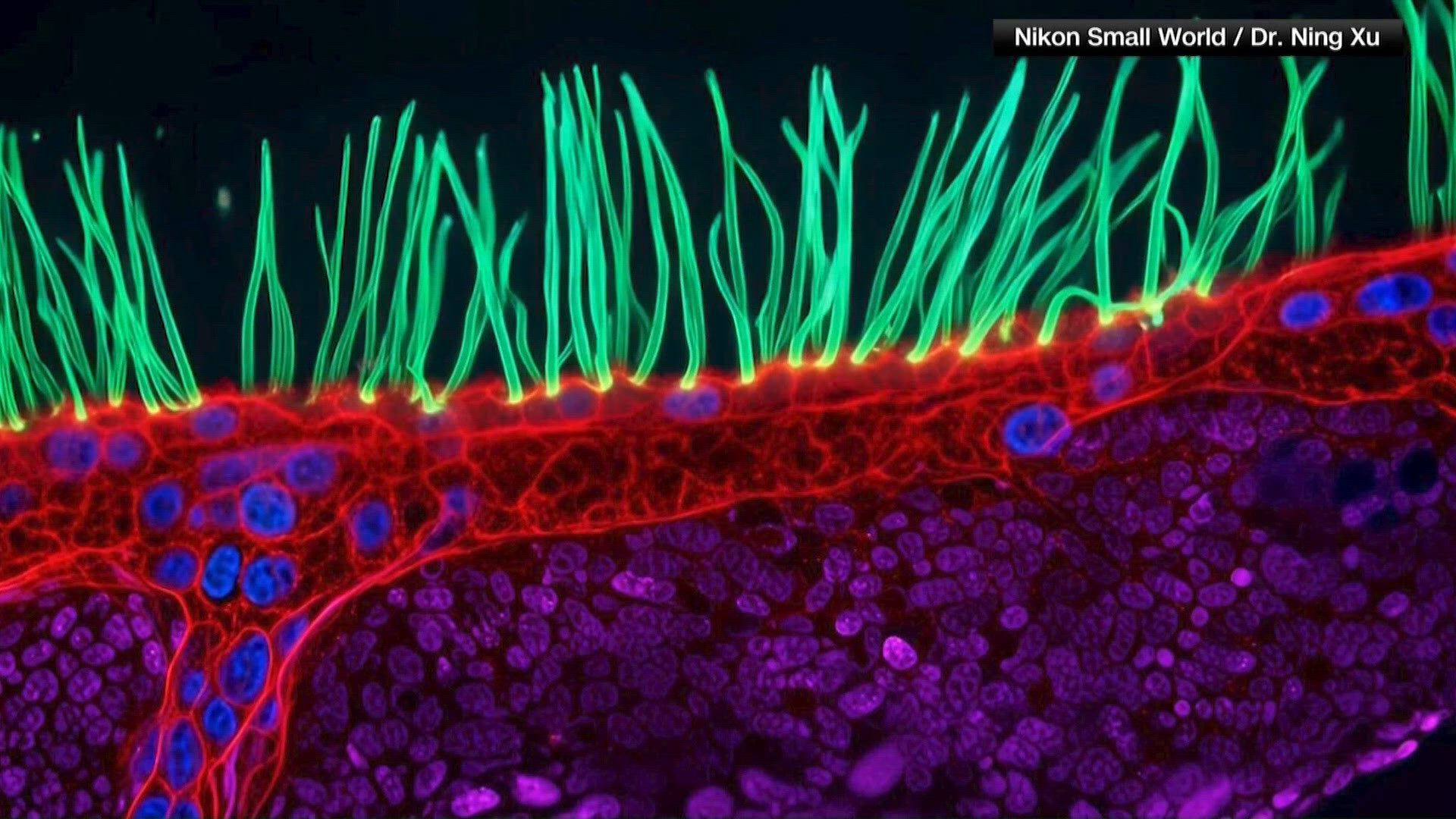 Microscope Use Guid Nikon’s microscopy competition faces scrutiny after winning video is ...