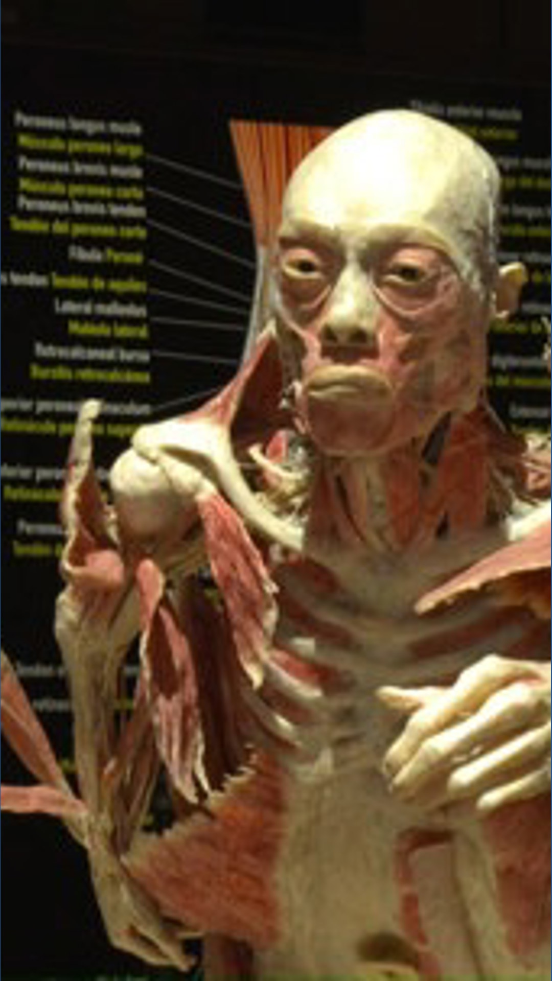 Human Collection ‘Bodies’ exhibit featuring preserved human specimens opens in ...