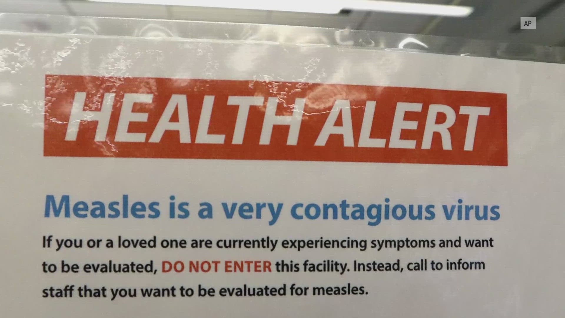 Measles is a highly contagious viral illness that’s often serious for small children but can be prevented by vaccination.