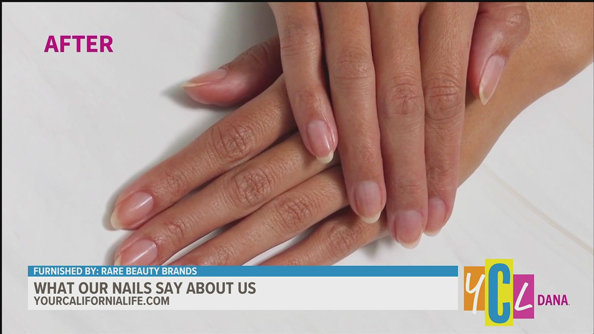 We're debunking myths when it comes to our manicures and what the condition of our nails says about our health.