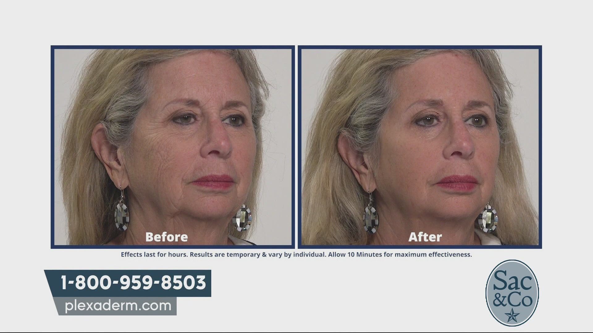 plexaderm dark circles