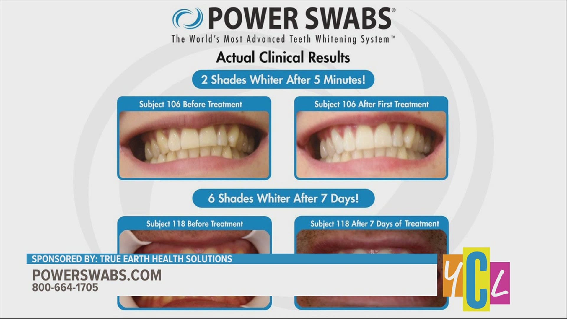 Show yourself some extra love by taking care of you. Check out how you could whiten your smile with Power Swabs. This segment paid for by True Earth Health Solutions