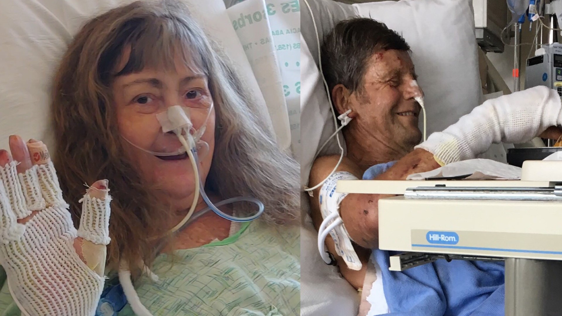 Couple who survived Camp Fire still in recovery at UC Davis hospital