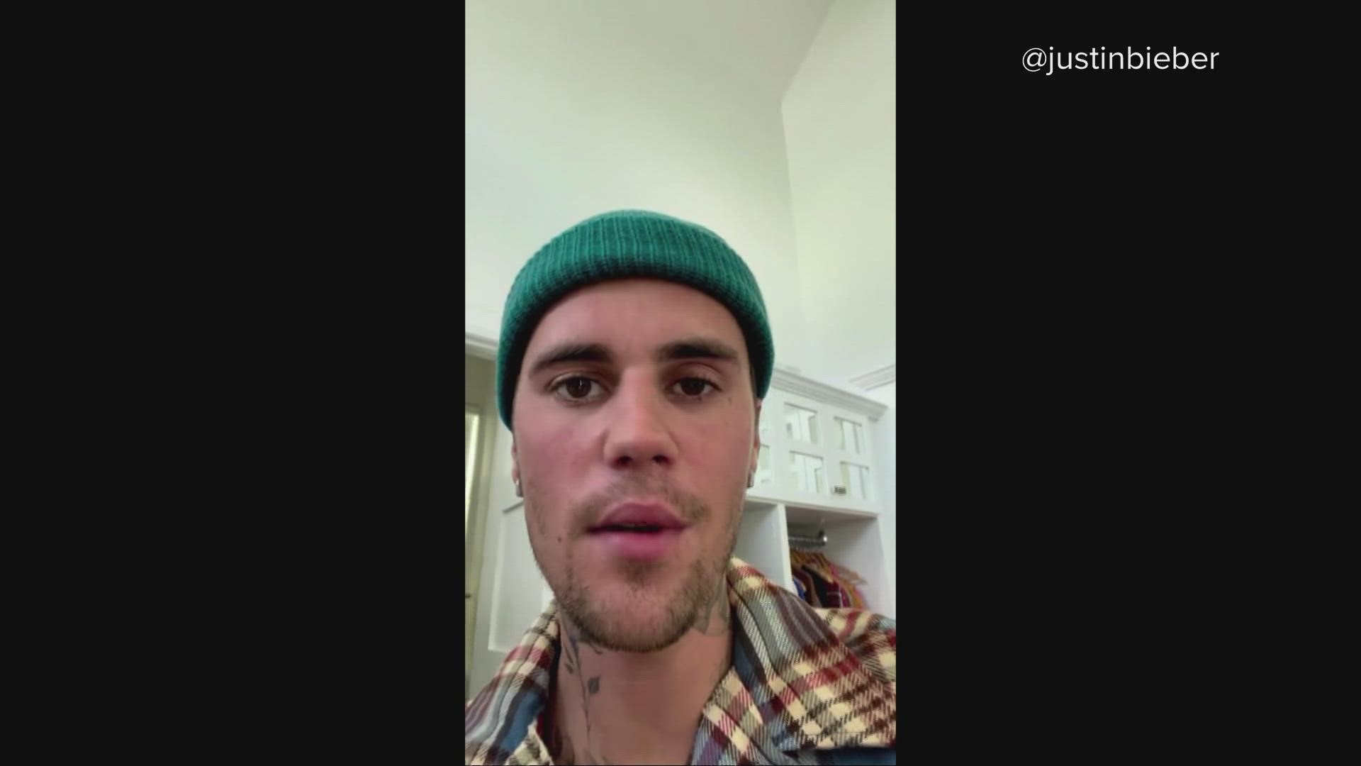 Bieber demonstrated in a video that he could barely move one side of his face, calling the ailment “pretty serious.”