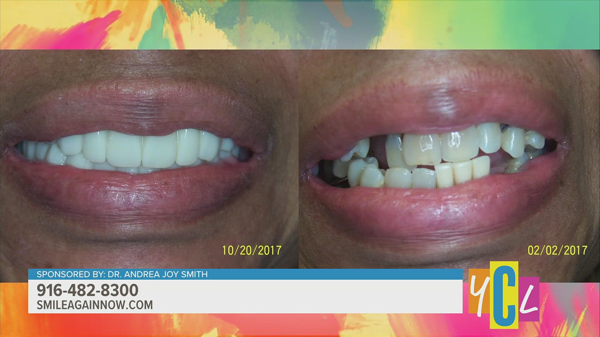 Dr. Andrea Joy Smith is helping her patients smile again with mini dental implants. This segment is paid by Dr. Andrea Joy Smith.