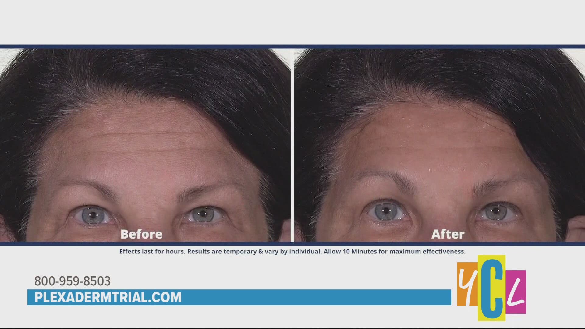 Plexaderm reduces under eye bags, dark circles, and wrinkles from view. This segment was paid for by True Earth Health Solutions.
