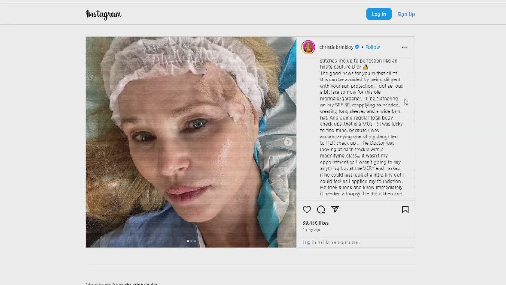Christie Brinkley's skin cancer diagnosis highlighted the importance of awareness and early protection.