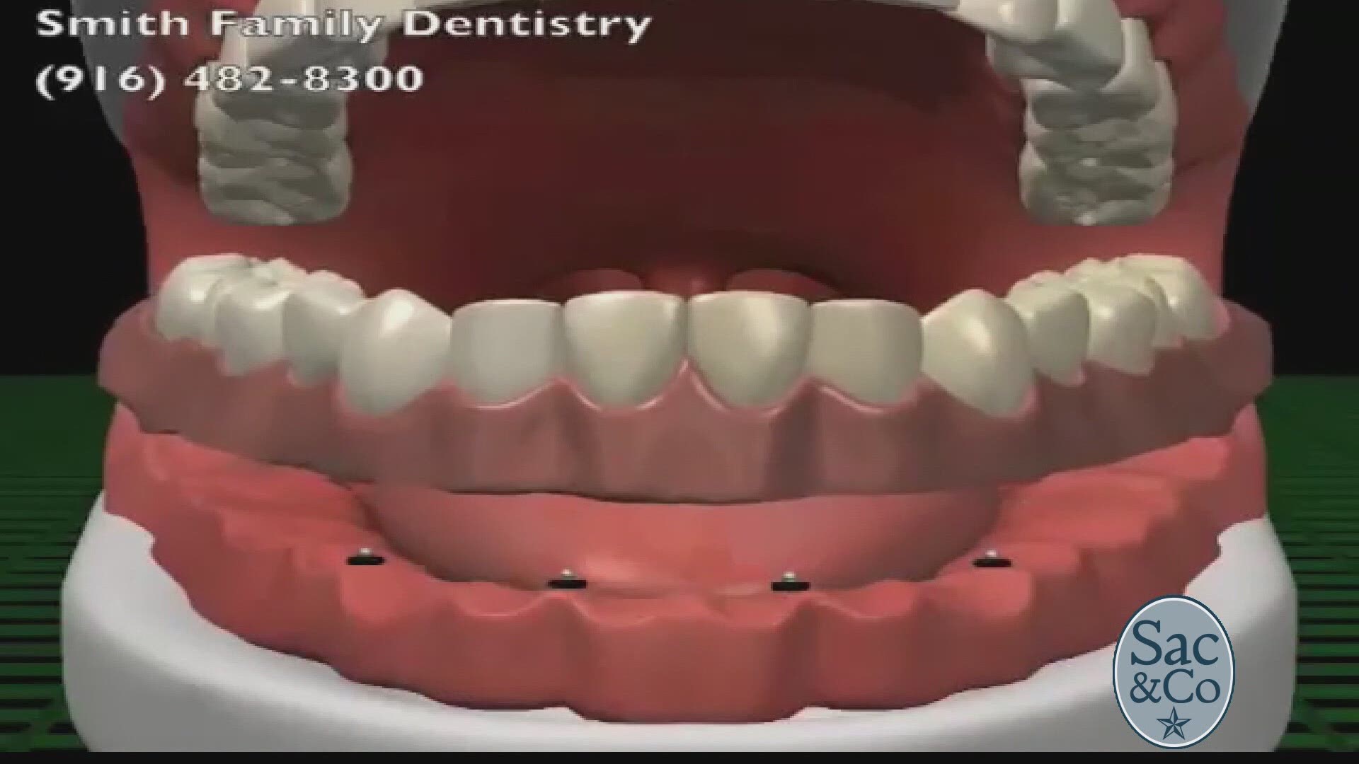 Mellisa Paul chatted with Sacramento’s Dr. Andrea Joy Smith about one of the latest techniques in dentistry. The following is a paid segment sponsored by Dr. Andrea Joy Smith.