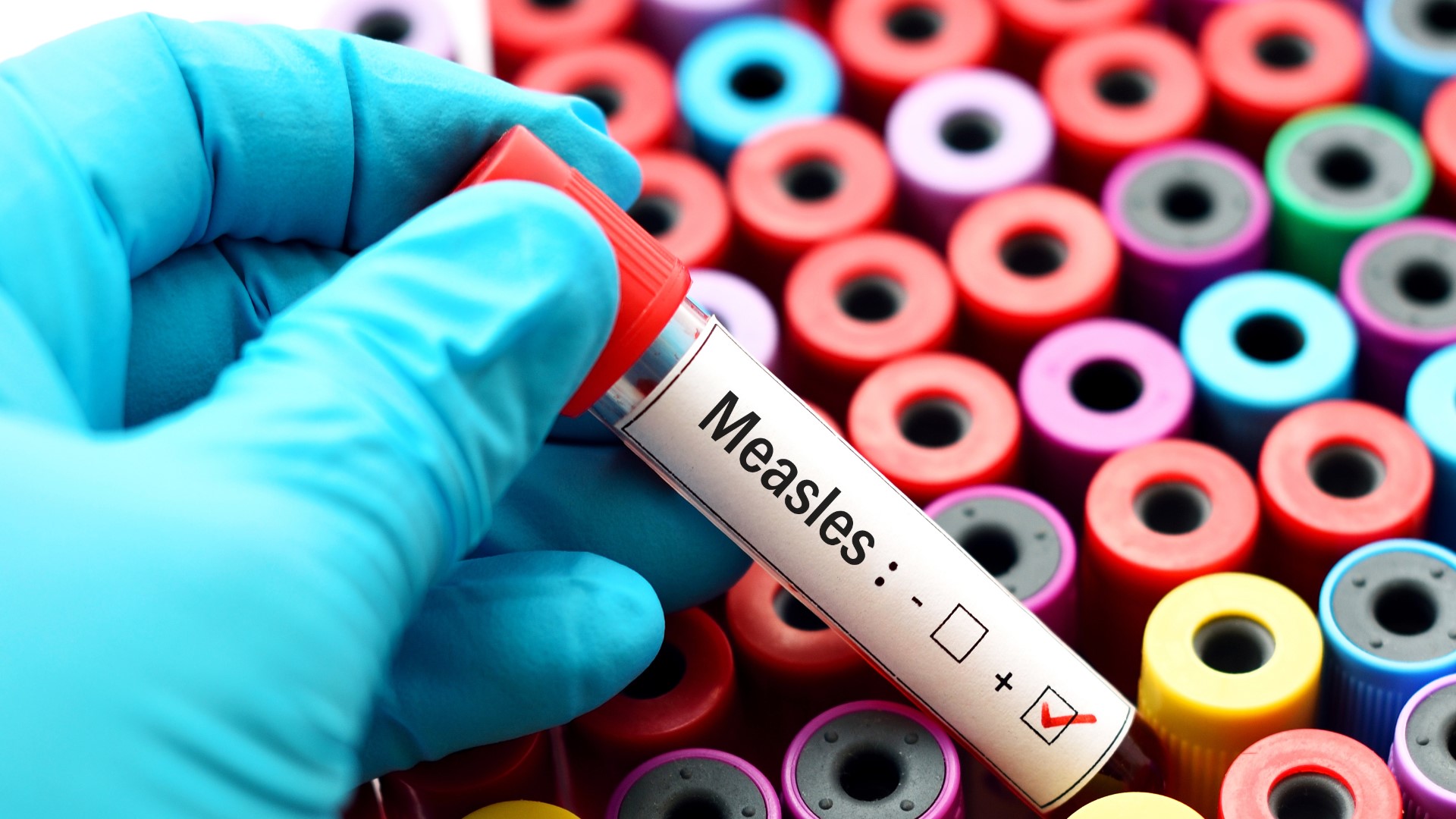 The current measles outbreak across the country is the largest since it was declared eliminated in 2000. Nearly 700 measles cases have been reported. As of Friday, around 300 students at Cal State -Los Angeles and UCLA were under quarantine.