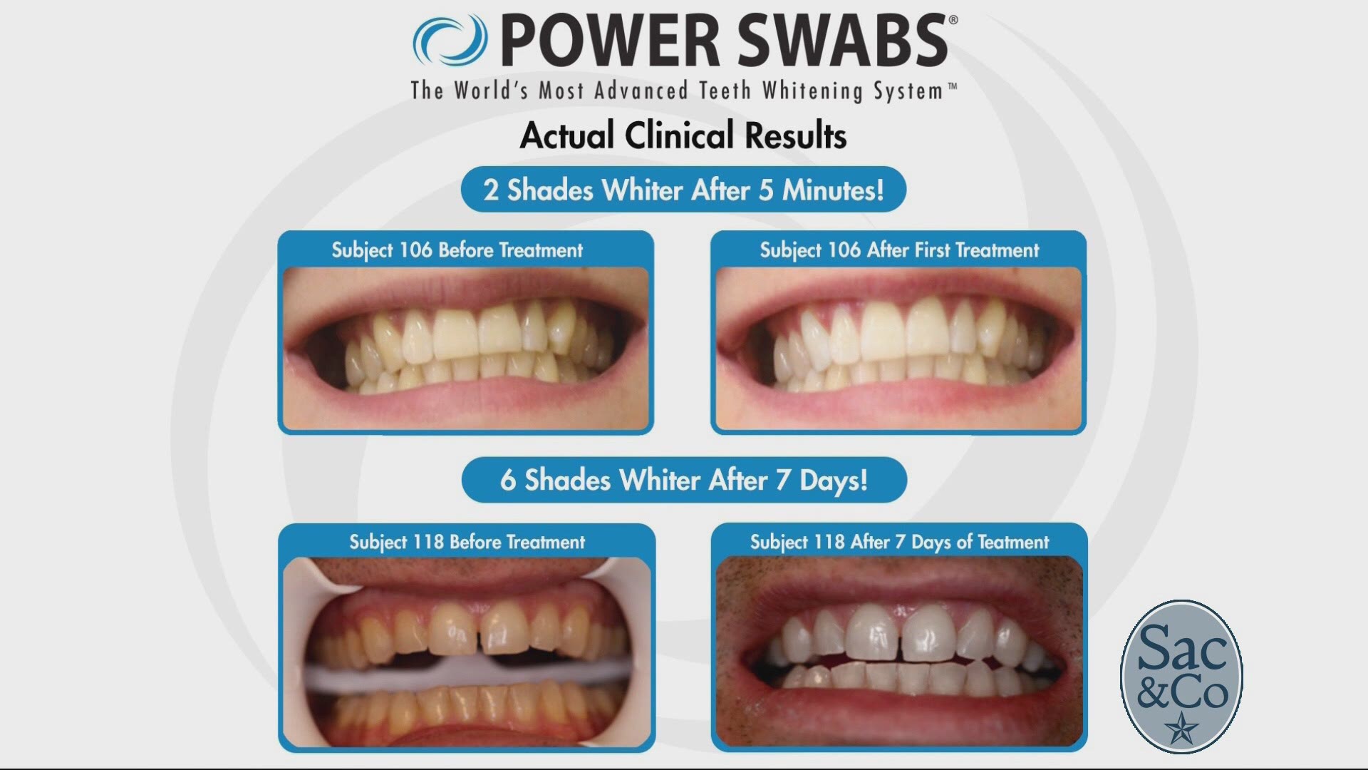 Learn how Power Swabs could possibly give you whiter teeth in just five minutes with minimal to no sensitivity! The following is a paid segment sponsored by True Earth Health Solutions.