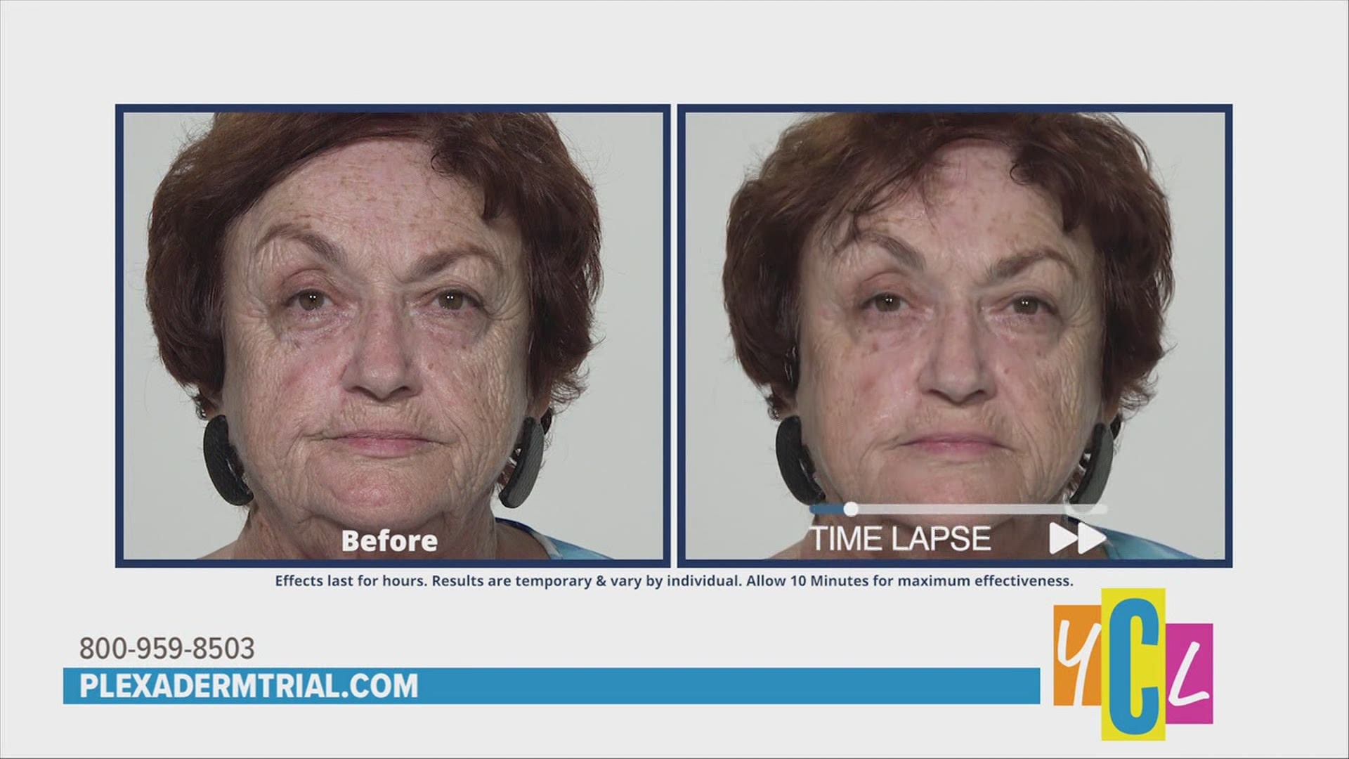 Alison Fiore share's before and after photos of skincare results of customers who've used Plexaderm. This segment paid for by True Earth Health Solutions.