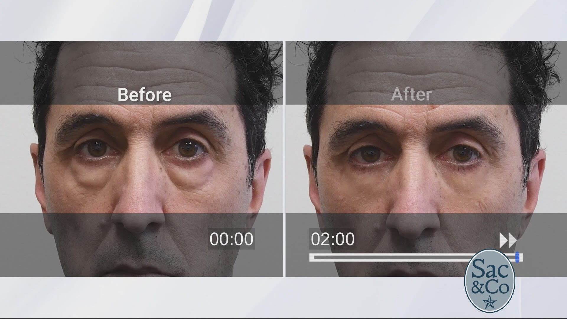 plexaderm dark circles