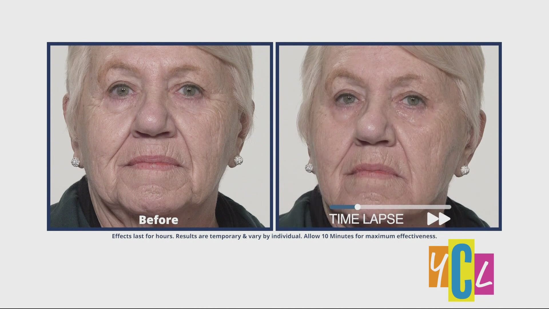 Reduce under eye bags, dark circles, and wrinkles from view using Plexaderm. This segment was paid for by True Earth Health Solutions.
