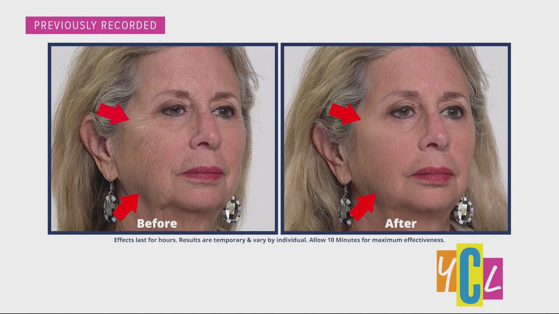 Get rid of those unwanted wrinkles, under eye bags, and dark circles in as little as five minutes. The following is a paid segment.