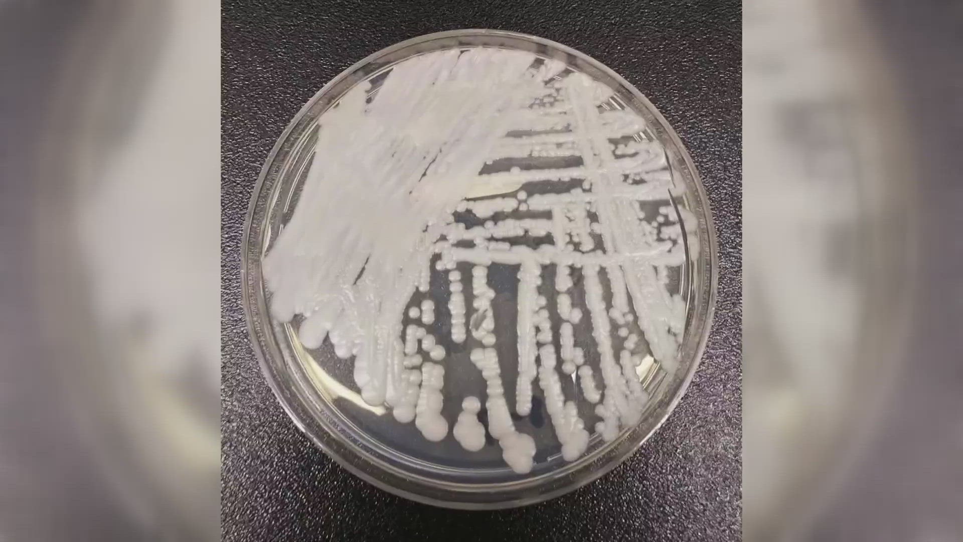The fungus is a multi-drug resistant yeast able to spread in healthcare settings and can cause serious, hard-to-treat infections. Here's what you should know.