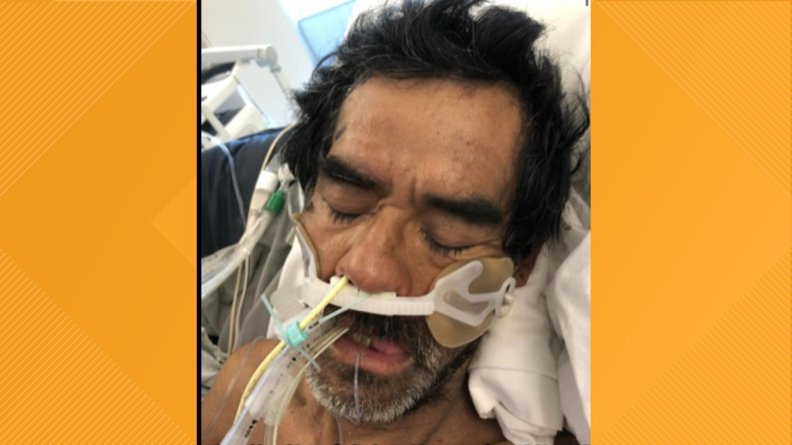 Man's condition worsens after Lodi hit and run leaves him in coma - Vimarsana News