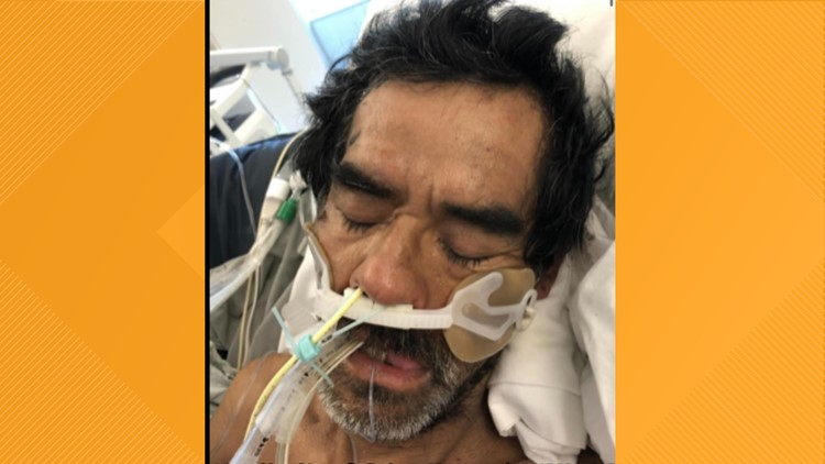 Man's condition worsening after Lodi hit and run leaves him in 2-week coma
