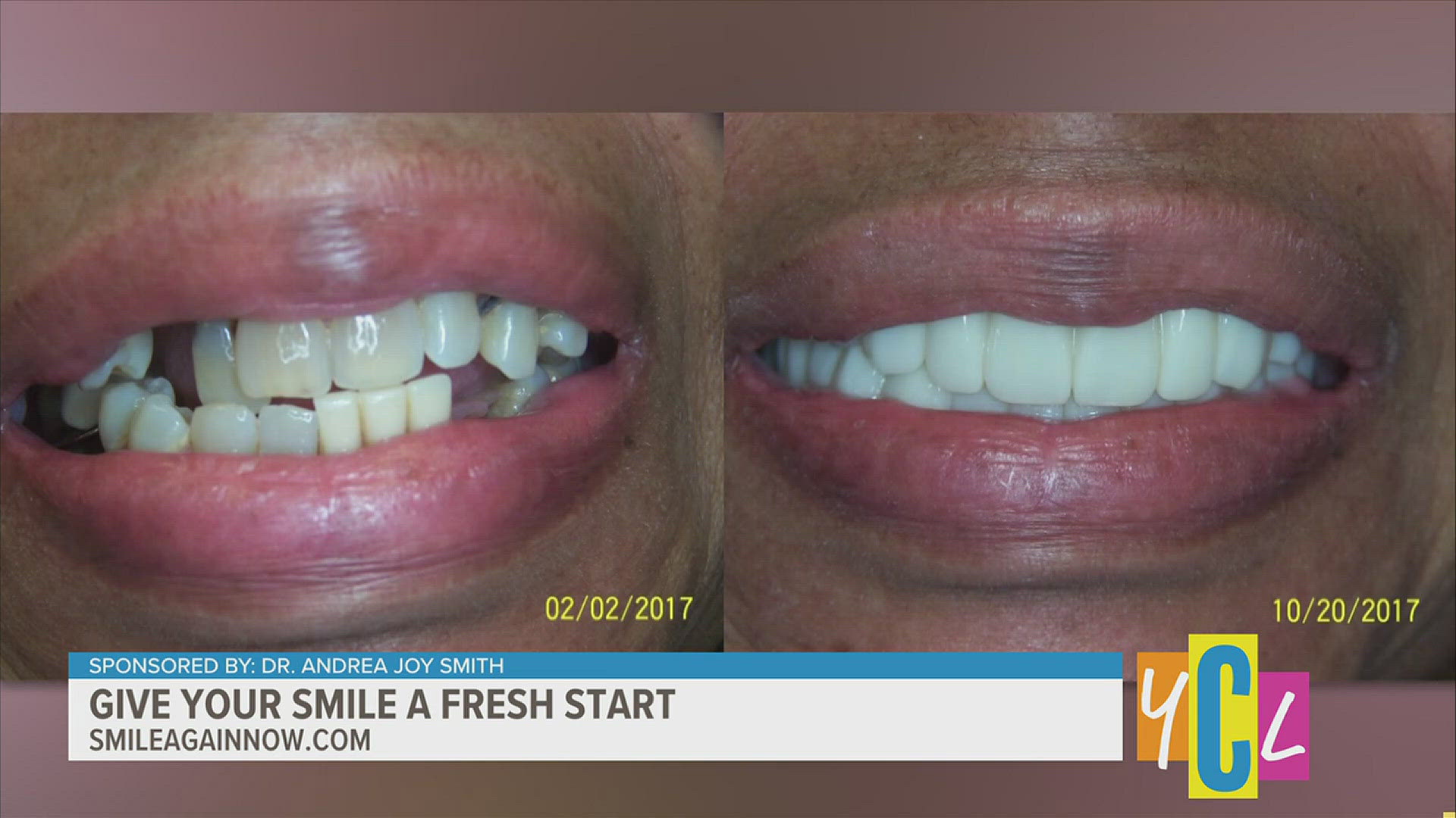 It can be easy to put off scheduling those dental check-ups, but here's why you don't want to wait. Sponsored by Dr. Andrea Joy Smith.