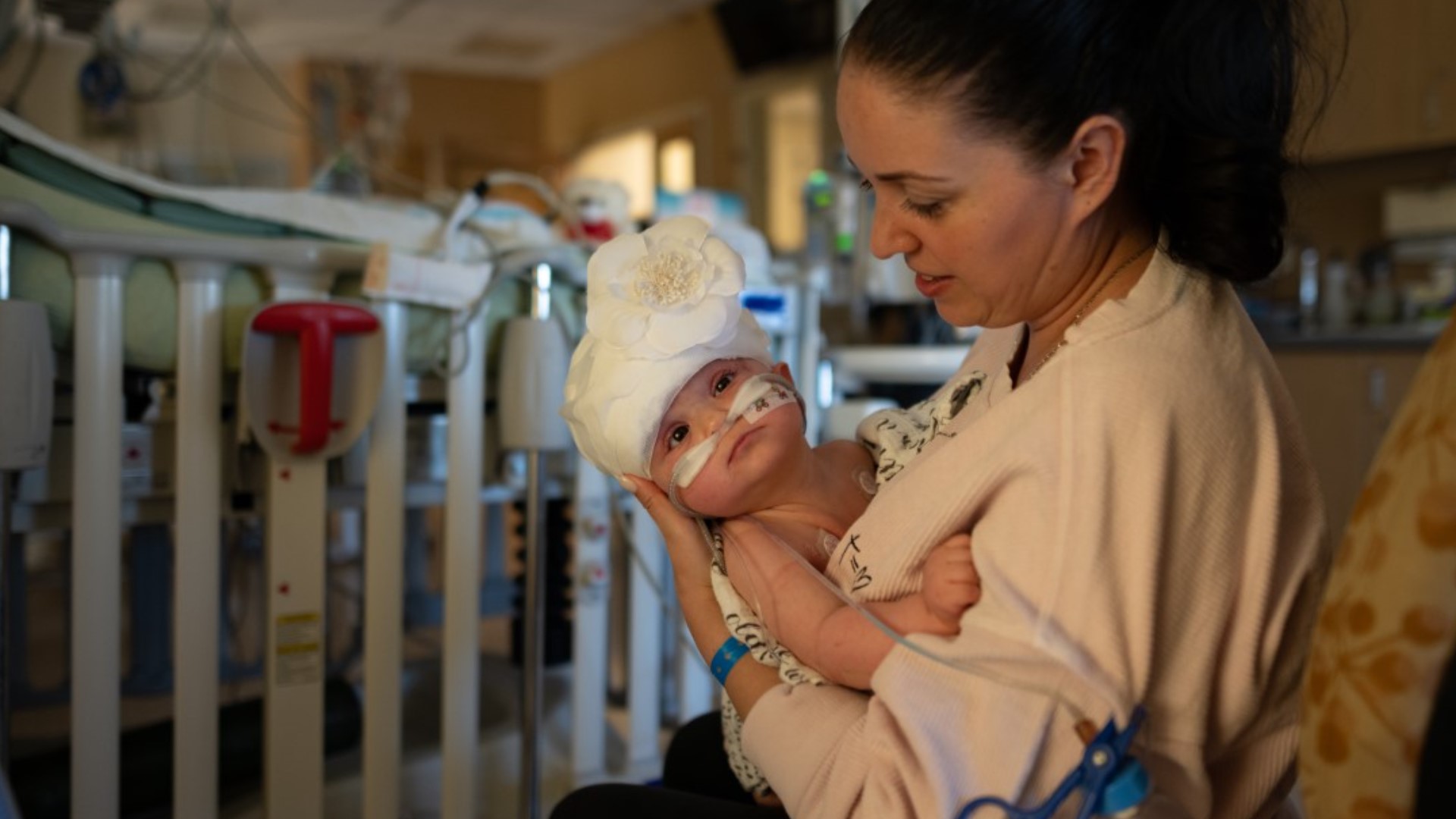 Abigail and Micaela Bachinskiy were the first conjoined twins to be successfully separated at the UC Davis Medical Center.