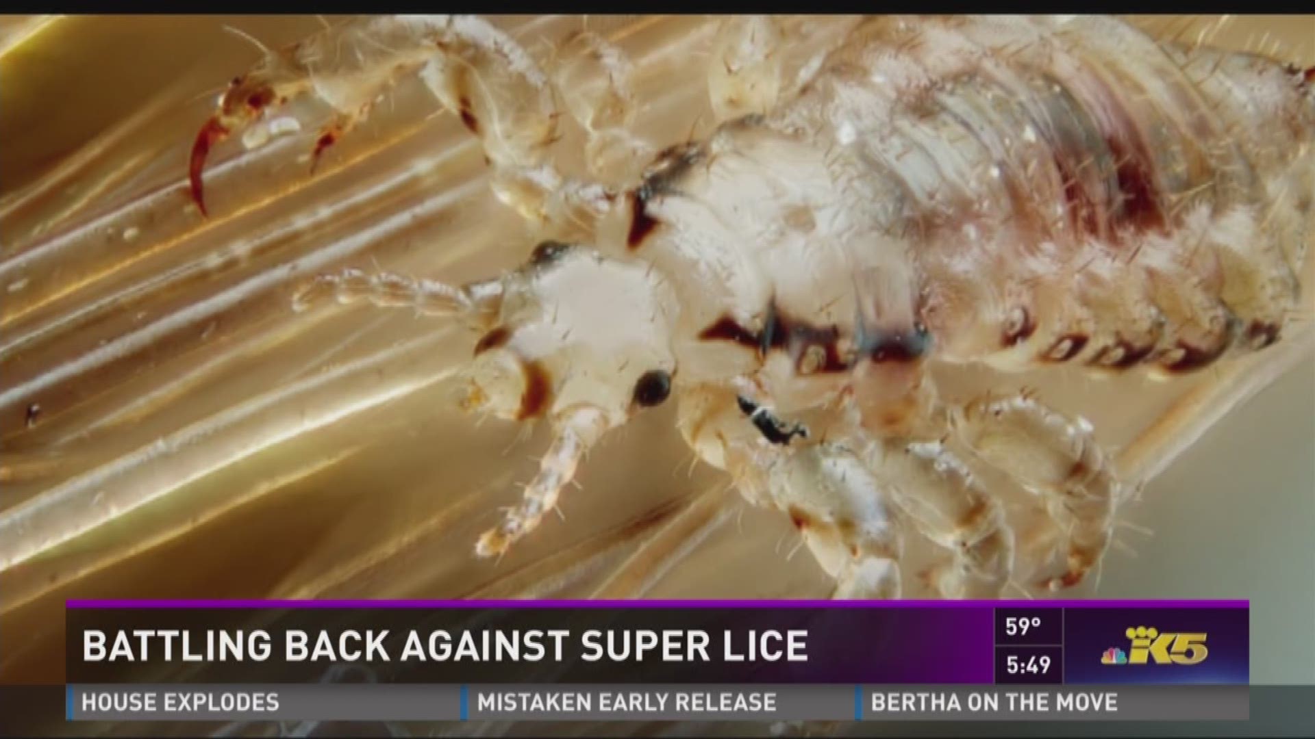 Parents hate to see the announcement: lice at their kid's school. Now, some of those lice are getting super-powered, but there's a new weapon against them.