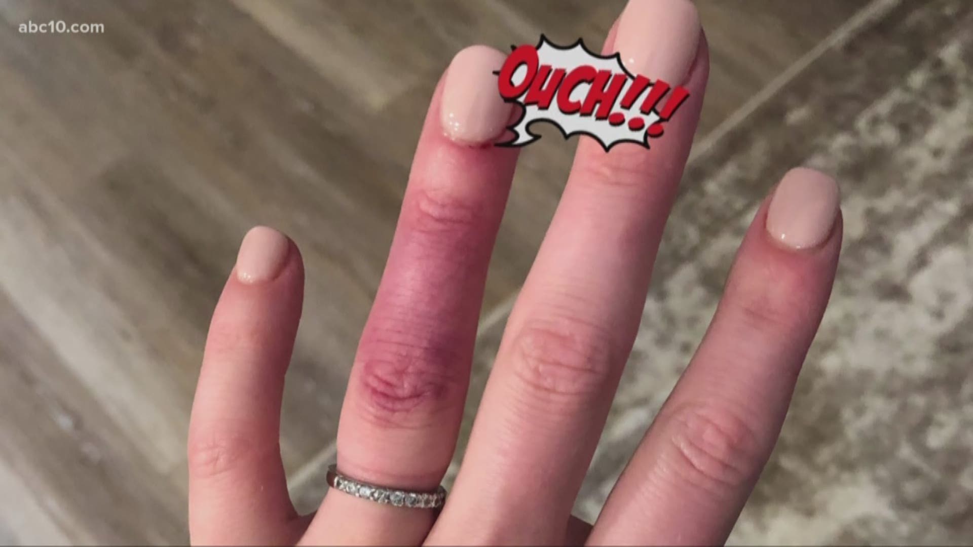 A trip to the nail salon ended with ABC10's Madison Meyer getting a painful finger infection. The incident left her wondering about the regulations that govern salons. And what consumers can do if they find themselves in a similar place.