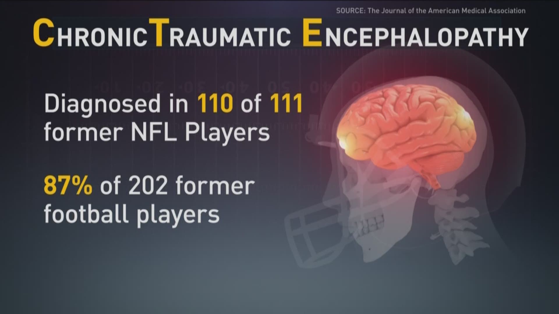 99-percent-of-studied-brains-from-dead-nfl-players-had-cte-abc10