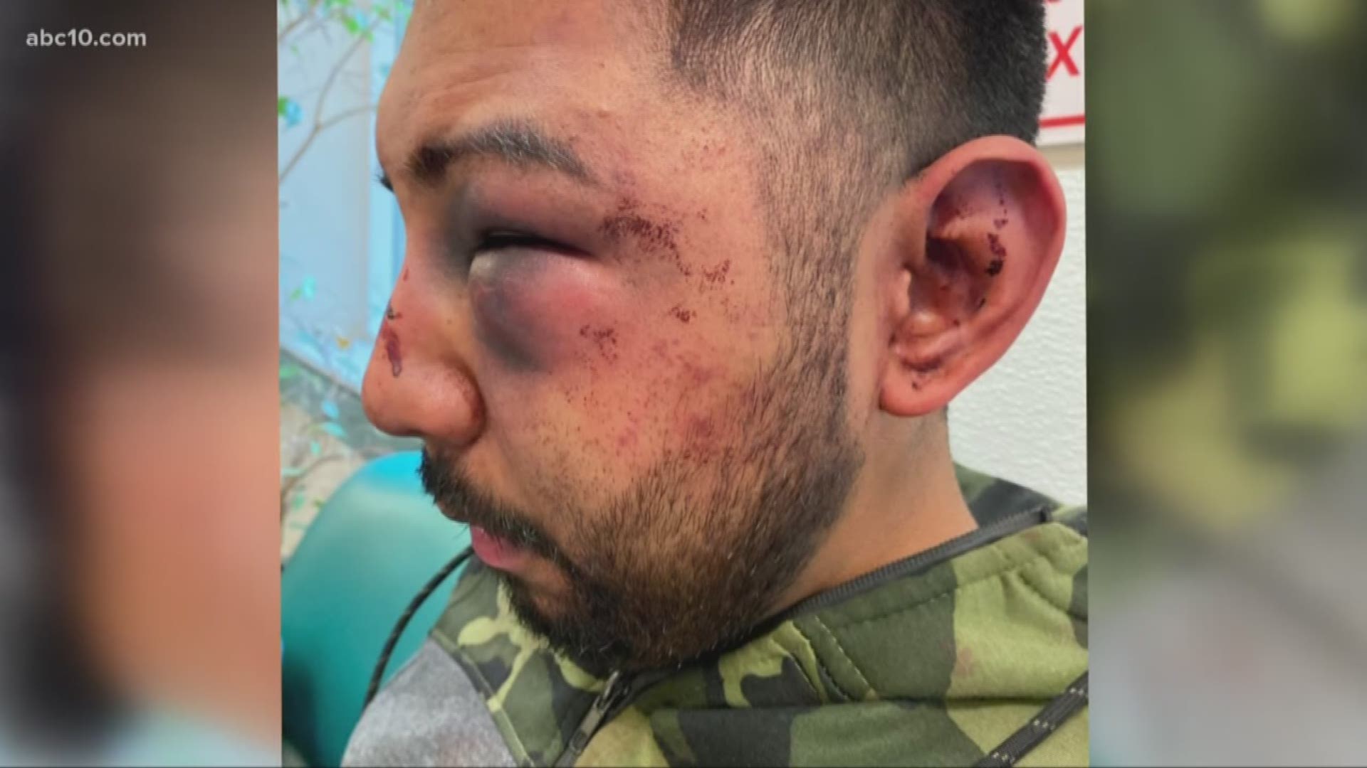 Jacob Servin was facing five counts of battery on a custodial officer after he was allegedly beaten and bloodied by officers inside of the San Joaquin County Jail.