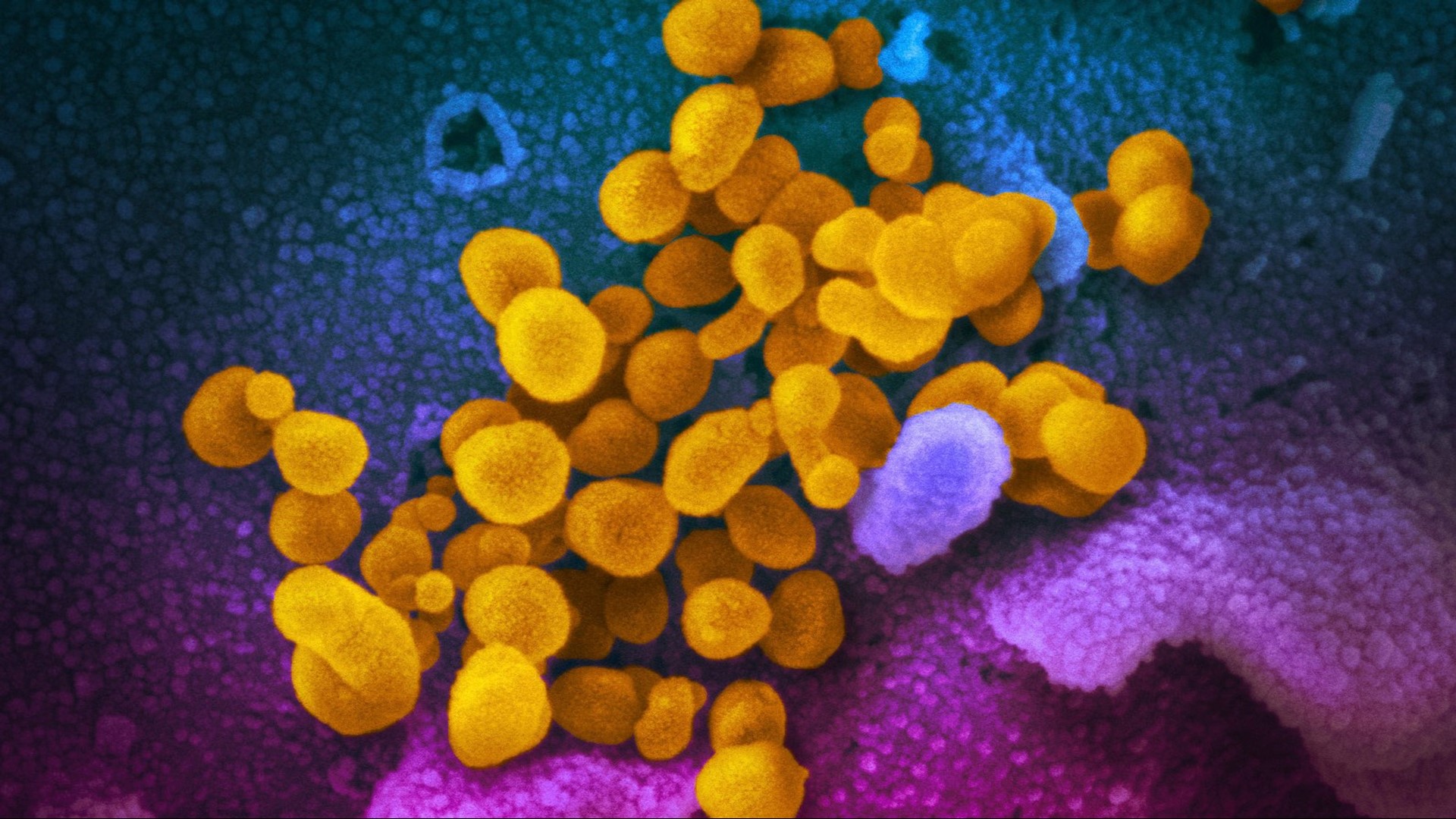 ABC10 viewers asked questions about the coronavirus.  Here is what our team has found out.