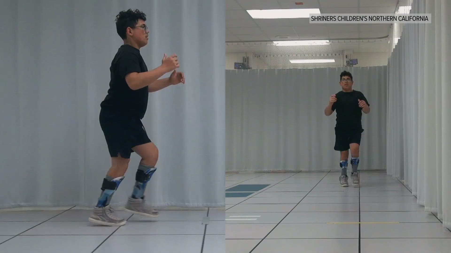 Motion capture technology, similar to what you would see in Hollywood, is applied to analyze gait and better target surgical treatment for cerebral palsy.
