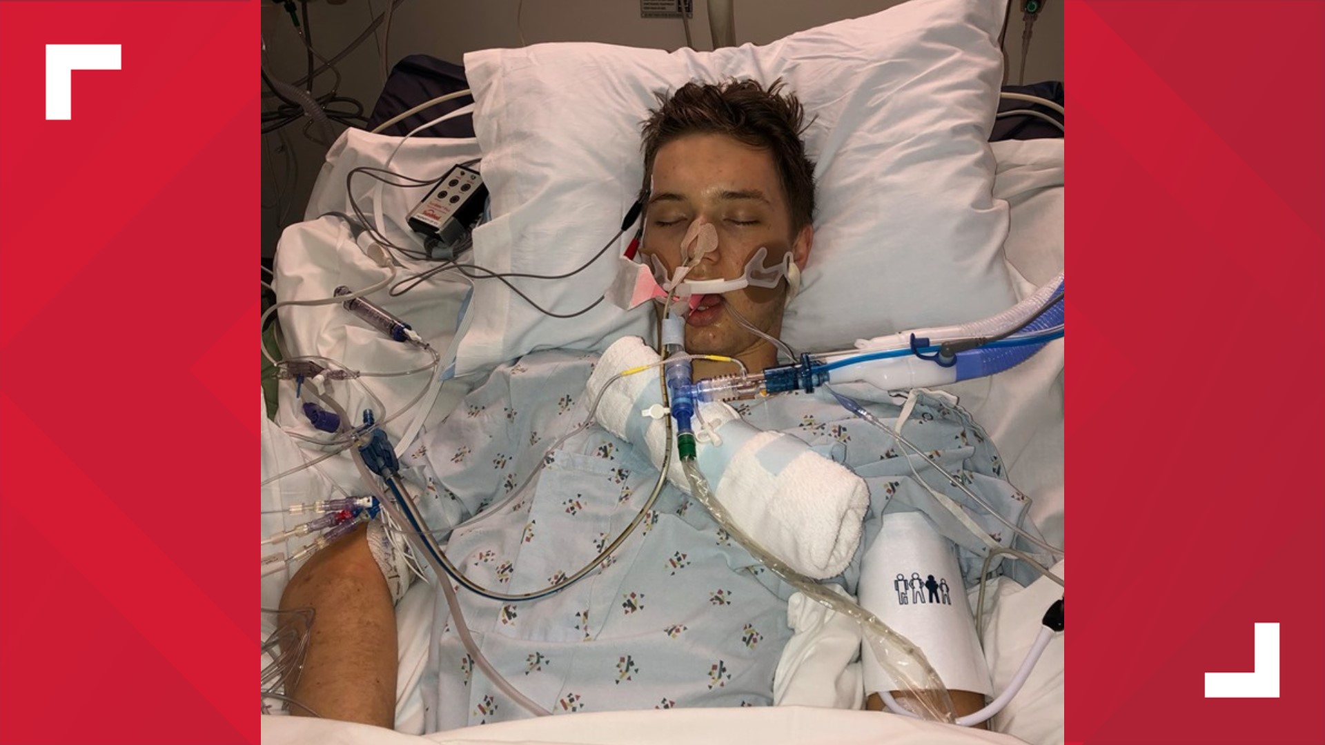 Ricky D'Ambrosio, 21, is fighting for his life in an area hospital after his mother, Christy, said he developed acute respiratory failure from vaping.