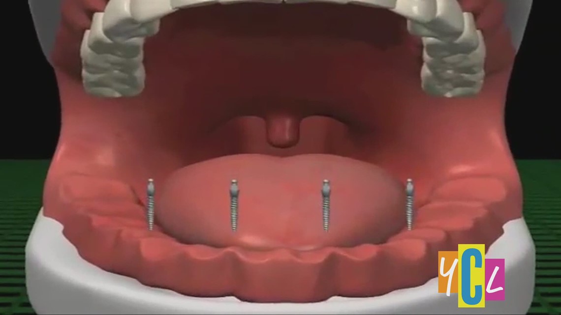 Mini-Dental Implants with Dr. Andrea Joy Smith | abc10.com