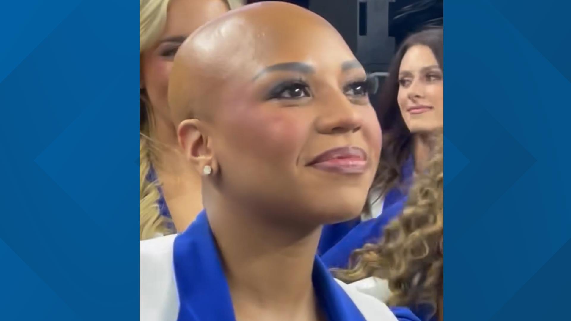 cowboys-cheerleader-cheers-without-wig-for-alopecia-awareness-abc10